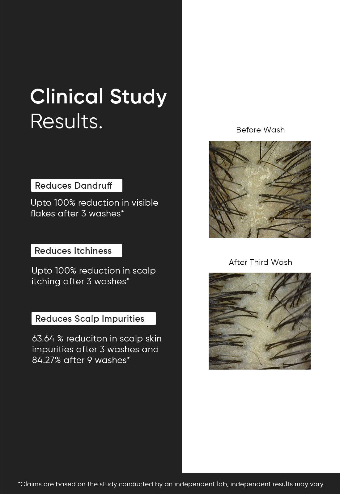 Anti Dandruff Shampoo 3.5% - Image 6